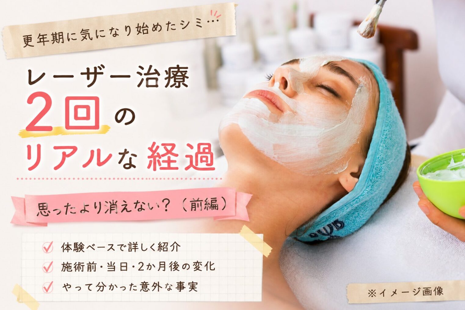 更年期で増えたシミ…レーザー治療2回のリアルな経過｜思ったより消えない？（前編）