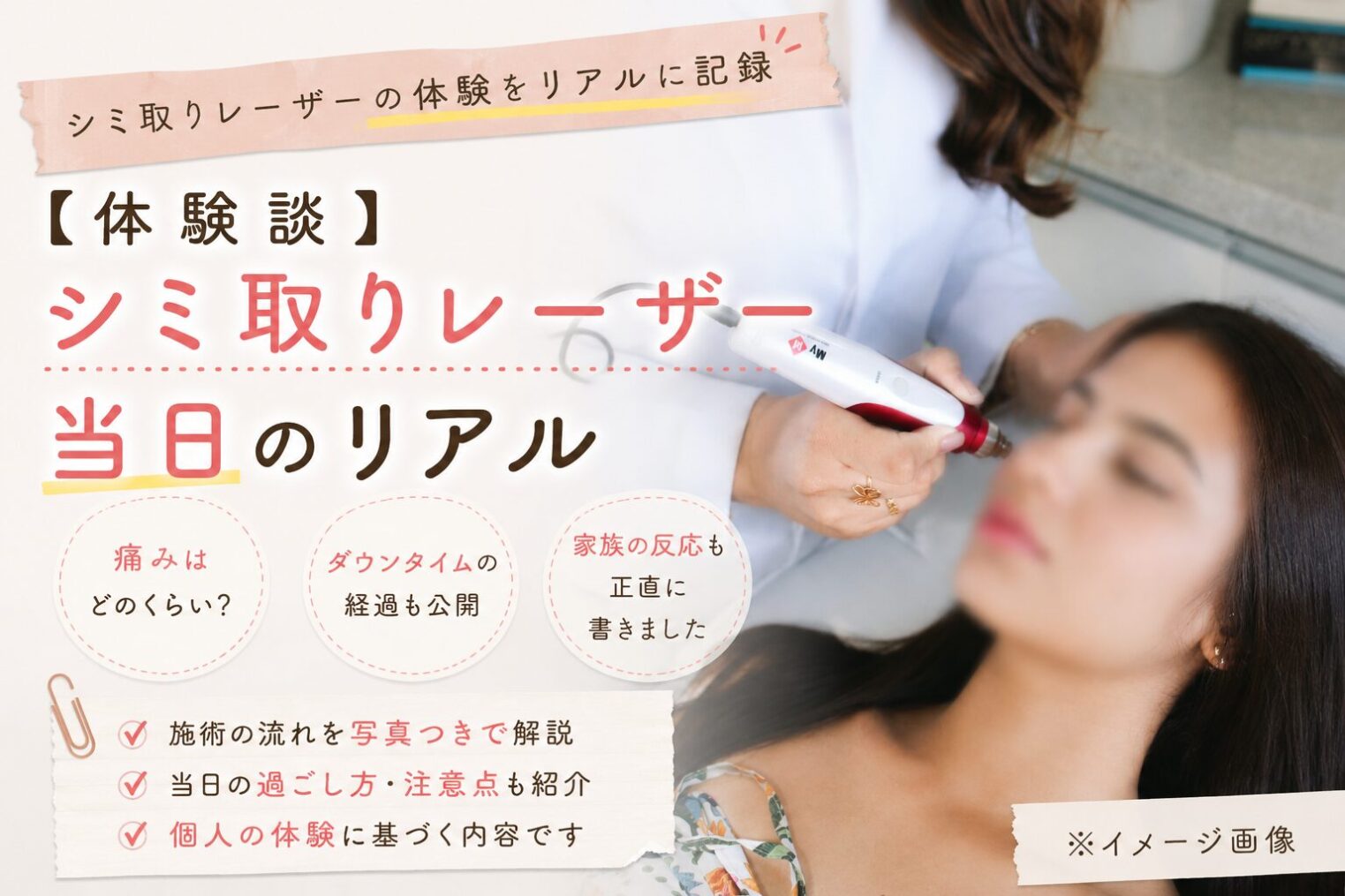 【体験談】シミ取りレーザー当日のリアル｜痛み・ダウンタイム・家族の反応（後編）