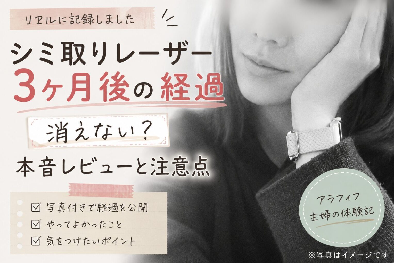 シミ取りレーザー3ヶ月後の経過｜消えない？本音レビューと注意点【写真あり】