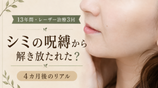 シミ取りレーザーを3回受けた結果｜13年間の経過と4カ月後のリアル