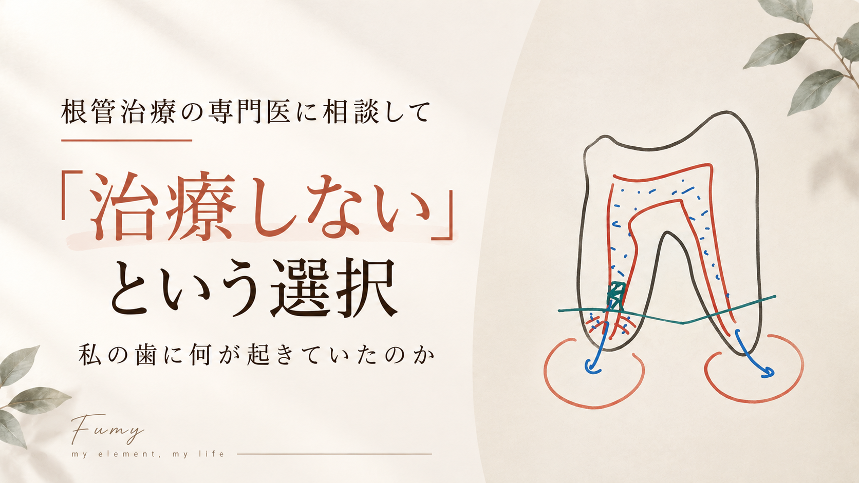 根管治療の専門医に相談して「治療しない」という選択｜私の歯に何が起きていたのか